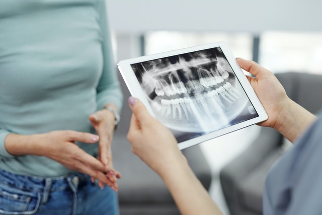 6 Scenarios That Simply Need Dental Filling Replacements