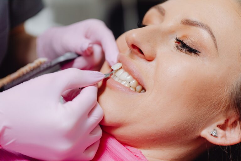 Best Things You Can Do to Prevent Staining Your Veneers