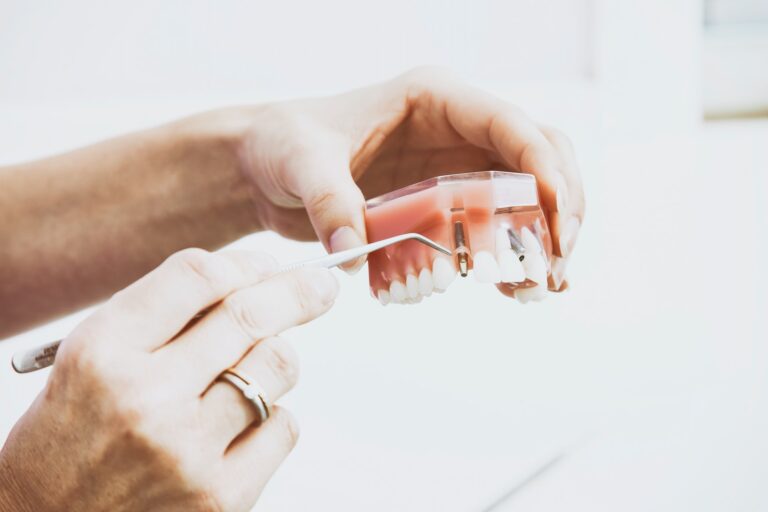 6 Mistakes That You Need to Avoid With Dental Implants