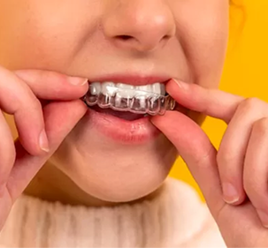 Fitting the Aligners