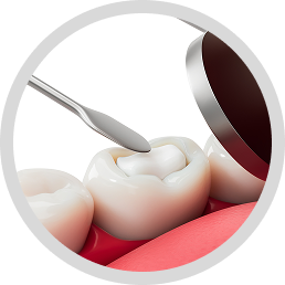 Porcelain fillings