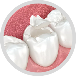 Temporary tooth fillings