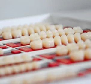 Temporary Veneers and Fabrication